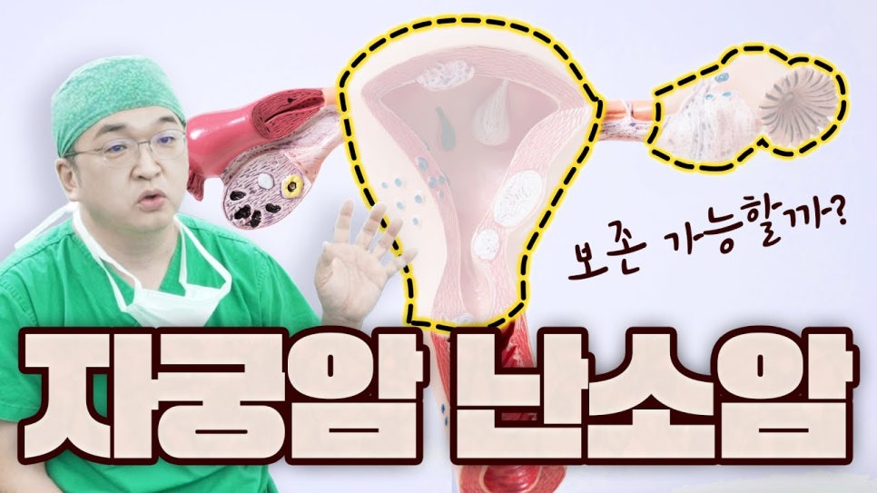 자궁암, 난소암의 치료! 자궁과 난소를 보존할 수 있을까요?